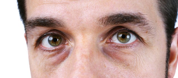 Puffiness & Dark Circles Be Gone?!